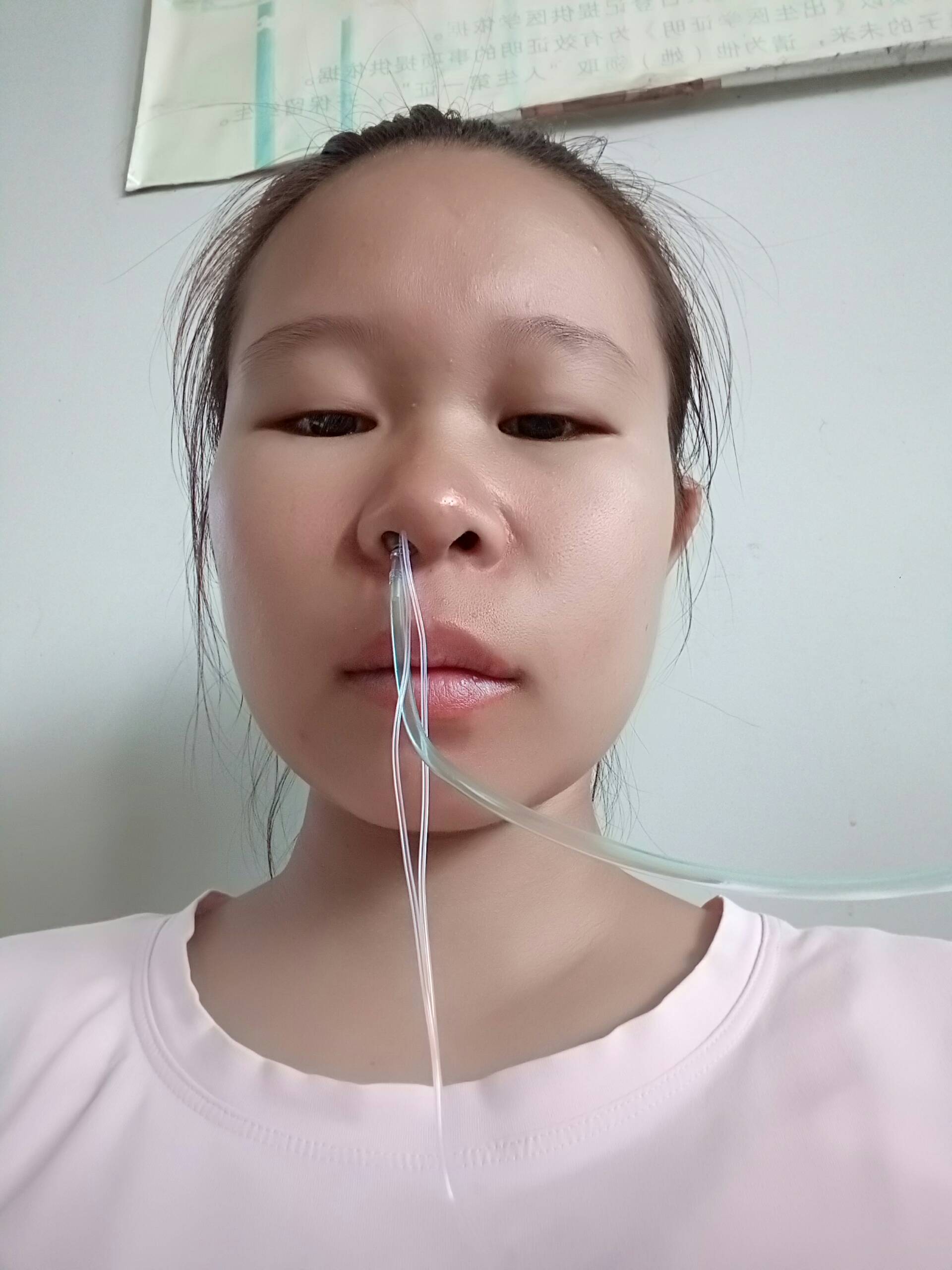 输氧气好难受,不想输氧9696最怕输氧气了0101 92不知不觉